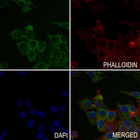 3 - Anti-Factor XI LC Antibody AP60167