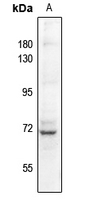 1 - Anti-Factor XI LC Antibody AP60167
