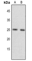 1 - Anti-FGF17 Antibody AP60168