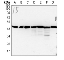 1 - Anti-FoxD4L5 Antibody AP60170