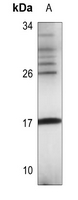 1 - Anti-FUNDC1 Antibody AP60171