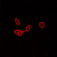 3 - Anti-GALR1 Antibody AP60172
