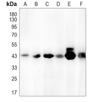 1 - Anti-GALR1 Antibody AP60172