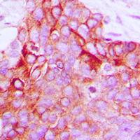 19 - Anti-GPR116 Antibody AP60174
