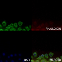 3 - Anti-GPR143 Antibody AP60176