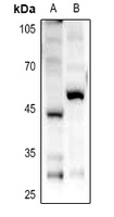 1 - Anti-GPR85 Antibody AP60179