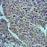 19 - Anti-HSD17B4 Antibody AP60180