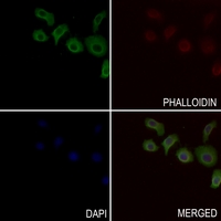 3 - Anti-IDH3 beta Antibody AP60181
