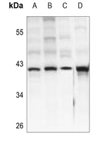 1 - Anti-IDH3 beta Antibody AP60181