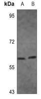 1 - Anti-IRF5 Antibody AP60182