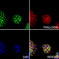 3 - Anti-ITIHC3 Antibody AP60183