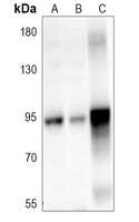 1 - Anti-ITIHC3 Antibody AP60183