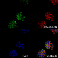 3 - Anti-ITIHC4 70k Antibody AP60184