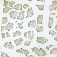 19 - Anti-ITIHC4 70k Antibody AP60184