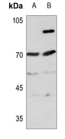 1 - Anti-ITIHC4 70k Antibody AP60184