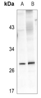 1 - Anti-Kallikrein 4 Antibody AP60185