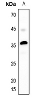 1 - Anti-MASP1 LC Antibody AP60188