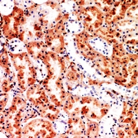 19 - Anti-M-CSF Antibody AP60189