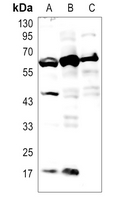 1 - Anti-M-CSF Antibody AP60189