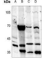 1 - Anti-Melatonin Receptor 1a Antibody AP60190