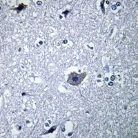 19 - Anti-mGLUR1 Antibody AP60191