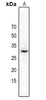 1 - Anti-MMP26 Antibody AP60192