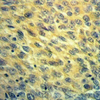 19 - Anti-NDUFB7 Antibody AP60193