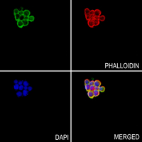 3 - Anti-Orosomucoid 1 Antibody AP60196