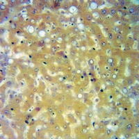 19 - Anti-Orosomucoid 1 Antibody AP60196