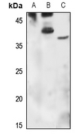 1 - Anti-Orosomucoid 1 Antibody AP60196