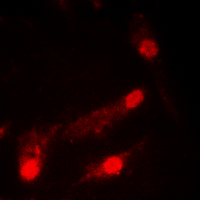 3 - Anti-p53 (Acetyl-K386) Antibody AP60197