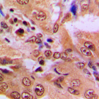 19 - Anti-p53 (Acetyl-K386) Antibody AP60197