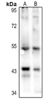 1 - Anti-p53 (Acetyl-K386) Antibody AP60197