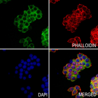3 - Anti-PICK1 Antibody AP60199