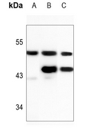 1 - Anti-PICK1 Antibody AP60199