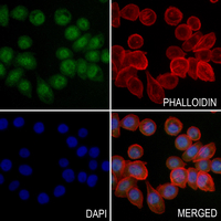 3 - Anti-Pokemon Antibody AP60200