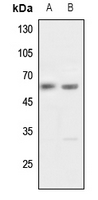 1 - Anti-Pokemon Antibody AP60200
