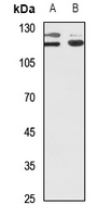 1 - Anti-PPP1R13B Antibody AP60202