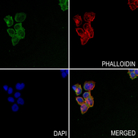 3 - Anti-REG4 Antibody AP60204