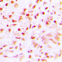 19 - Anti-SENP6 Antibody AP60205
