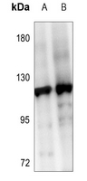 1 - Anti-SENP6 Antibody AP60205