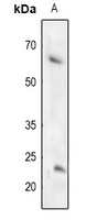 1 - Anti-TFCP2L1 Antibody AP60206
