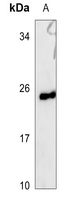 1 - Anti-UBE2E3 Antibody AP60207