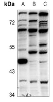 1 - Anti-GFI1B Antibody AP60208