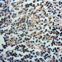 19 - Anti-Septin 8 Antibody AP60209