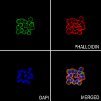 3 - Anti-A2M Antibody AP60210