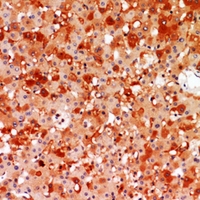 19 - Anti-A2M Antibody AP60210
