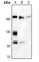 1 - Anti-A2M Antibody AP60210