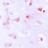 19 - Anti-ACC alpha (Phospho-S80) Antibody AP60211