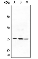1 - Anti-ACER2 Antibody AP60212